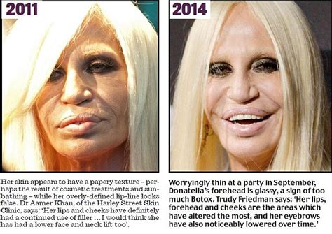 How Donatella Versace Transformed Herself Into A Human Waxwork Daily