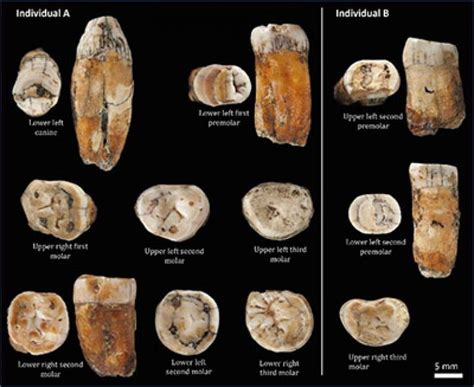 Neanderthal Teeth From La Cotte De St Brelade Jersey Hint At