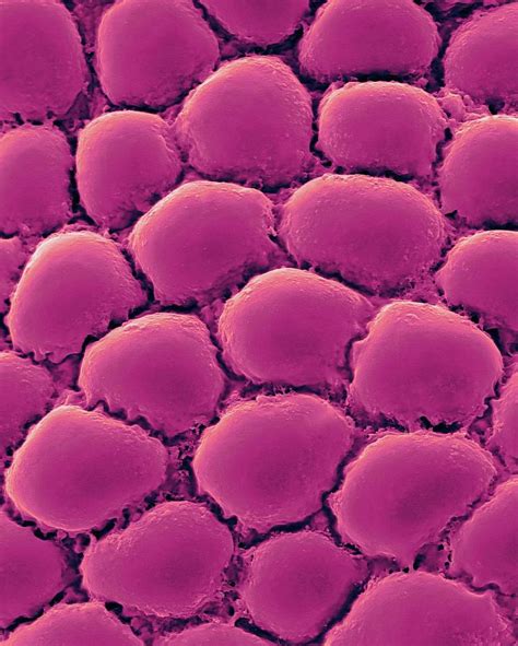 Fat Cells From Adipose Tissue Photograph By Dennis Kunkel Microscopy