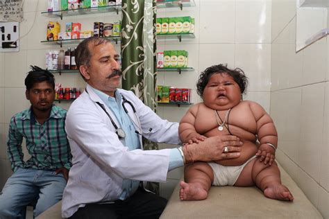 Morbidly Obese Baby Alarms Doctors By Weighing In At Nearly Three Stone