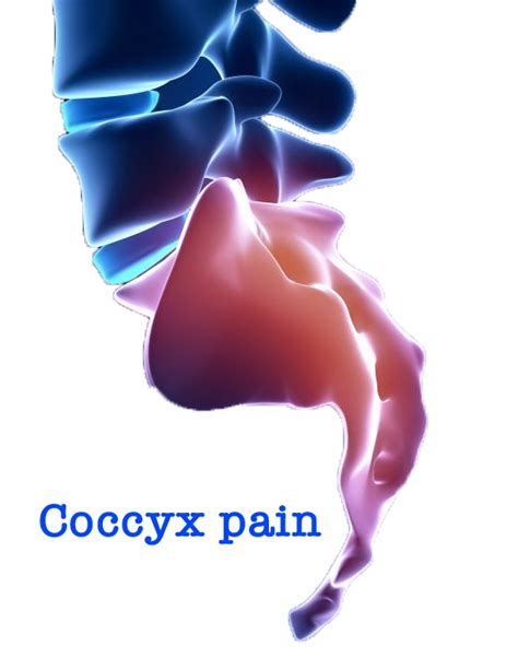 Coccyx Pain