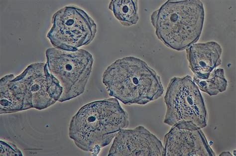 Bacterian cells differ from almost every human cells due to the absence of a nuclear membrane. Human Cheek Cell (wet mount under phase contrast) | Lab 2 ...