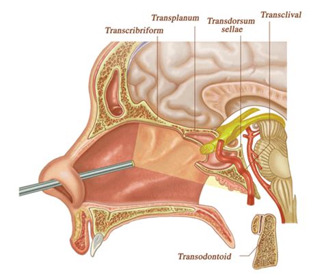 Best Neurosurgeon Brain Specialist Hospital In Delhi