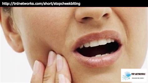 How To Stop Cheek Biting During Sleep Anxiety Leads To Cheek Biting