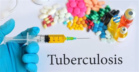 It has been known to mankind since ancient ages. Tuberculosis (TB): Common Symptoms, Treatment And ...
