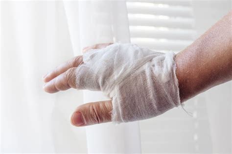 Bandaged Male Hand Due To Injury Treatment Of An Arm Cut Stock Photo