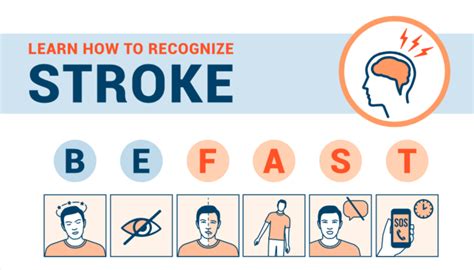 Learn How To Recognize A Stroke Rockledge Regional Medical Center