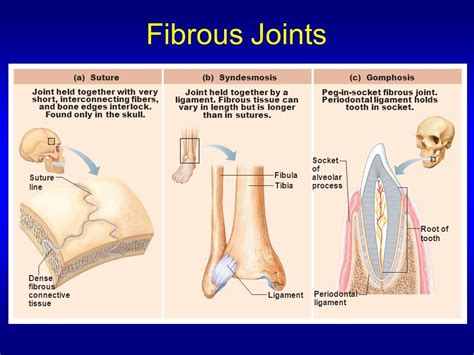 67 HD What Is A Gomphosis Fibrous Joint - Insectpedia