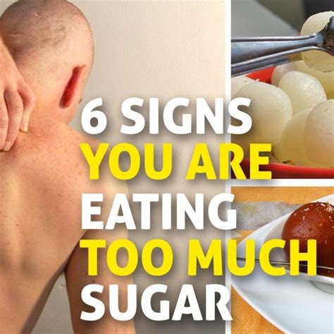 6 Signs Youre Eating Too Much Sugar