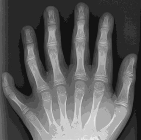 10 Shocking X Rays That Are Unbelievably Real