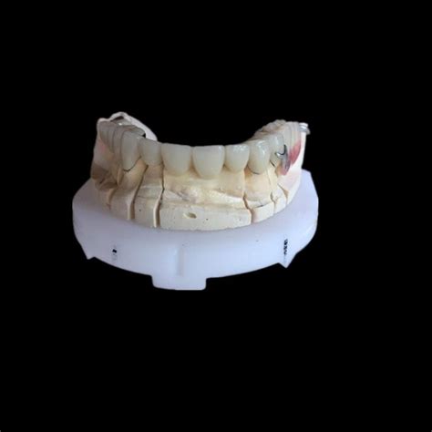PFM – Shenzhen Well Dental Laboratory