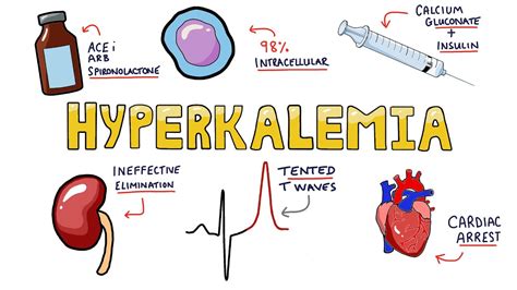 An Approach To Hyperkalemia Ecg Changes In Hyperkalemia What Are