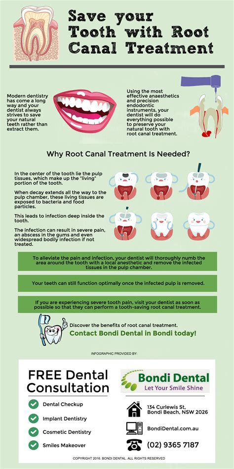 Check spelling or type a new query. Save your Tooth with Root Canal Treatment | Bondi Dental