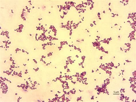 Streptococcus Agalactiae Microbiología Homo Medicus