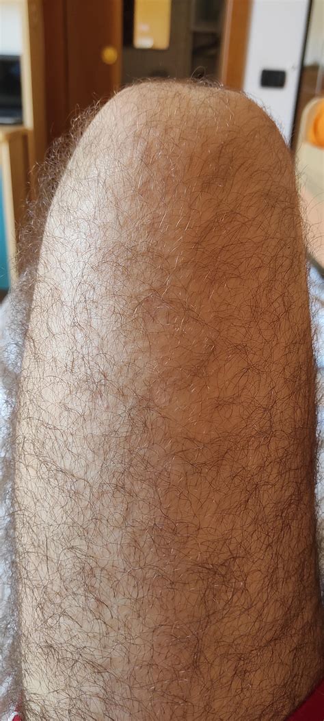 Are My Legs Too Hairy Lol Rmalegrooming