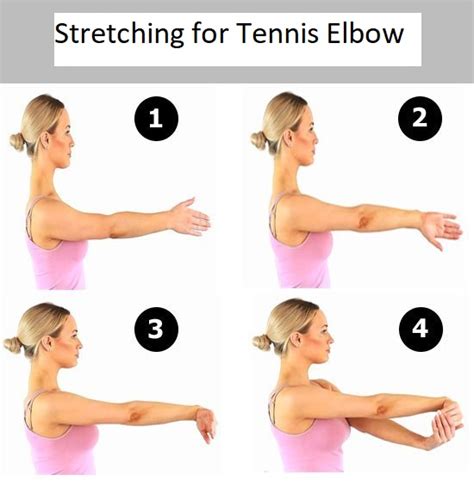 Lateral Epicondylitis Tennis Elbow Causes Symptoms Treatment How