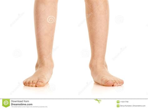 Valgus Deformity Of Legs Stock Photo Image Of Background 115017790