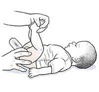 Discharge Instructions Taking A Rectal Temperature Pediatric Saint