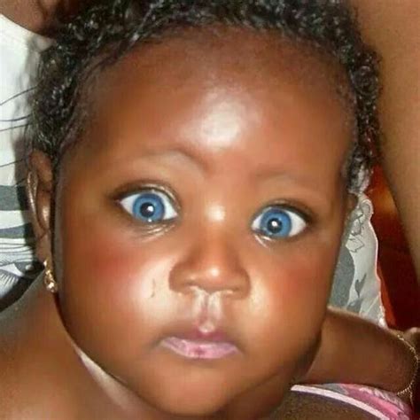 Pin On African Children With Blue Eyes