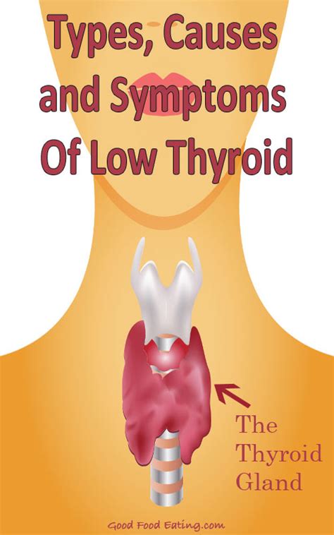A comparison of caucasian and japanese populations. Types, Causes and Symptoms Of Low Thyroid