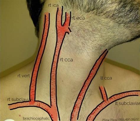 Of the two common carotid arteries, which extend headward on each side of the neck, the left originates in the arch of the. Neck Artery Anatomical Landmark