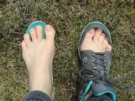 What Is A Tailors Bunion And How Do You Treat It The Foot Hub
