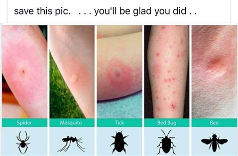 What Do Bed Bug Bites Look Like On Your Skin Thowad