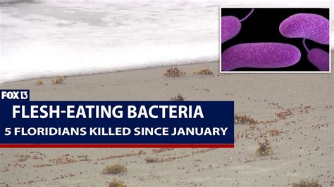 Flesh Eating Bacteria Kills 5 In Florida Youtube