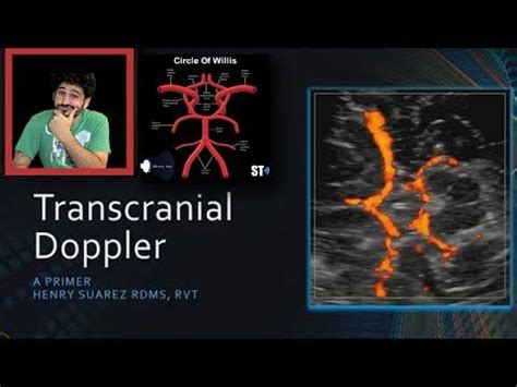 Transcranial Doppler Sonographic Tendencies Medical Ultrasound