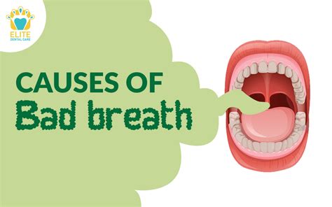 what are the main causes of bad breath elite dental care