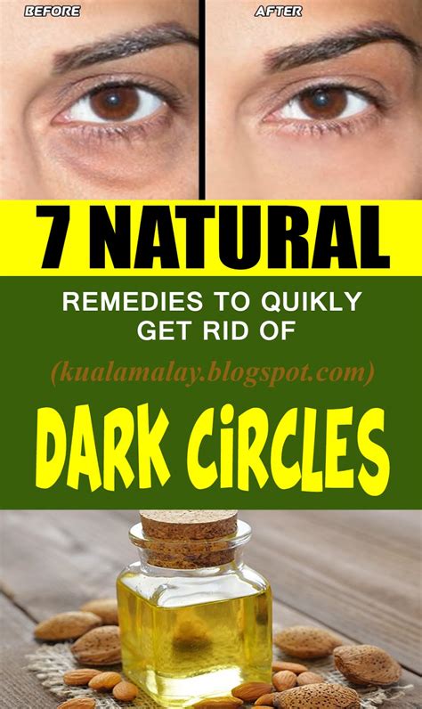 7 Natural Remedies To Get Rid Of Dark Circles