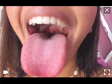 Jxmaican Queen Tongue Uvula Mouth Fetisg