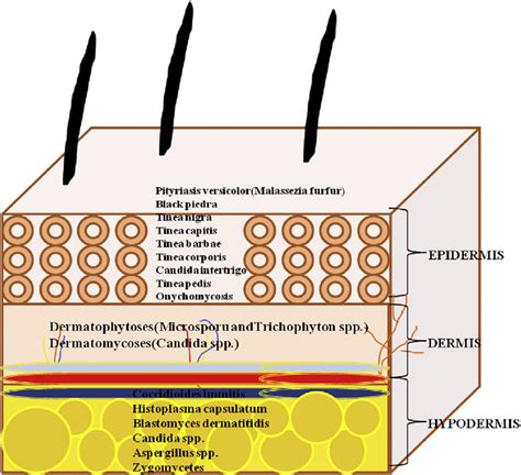 Layers Of Skin With Fungal Infections Download Scientific Diagram