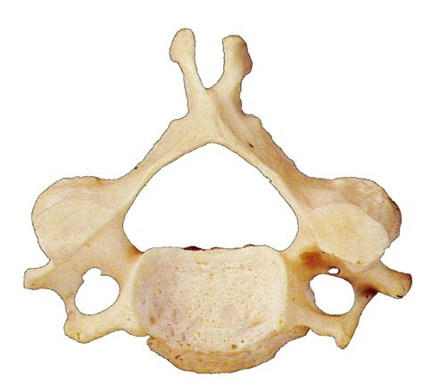 Osteomenagerie The Vertebrae Bone Broke