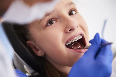 Ortodoncia Infantil Cuándo Empezar Y Tipos De Tratamiento Clínica