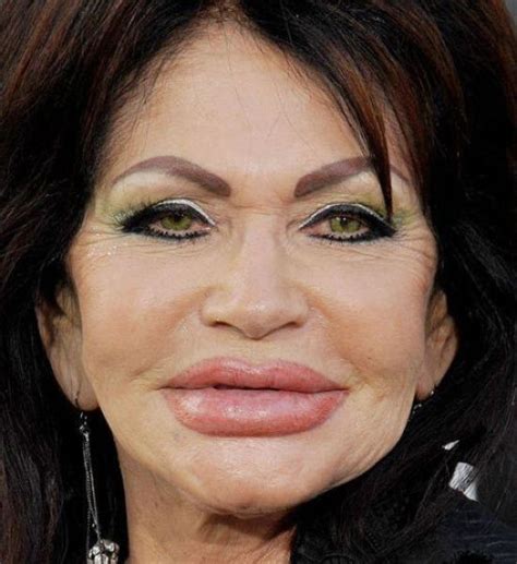 Horrifying Results Of Terrible Plastic Surgery Celebrity Plastic