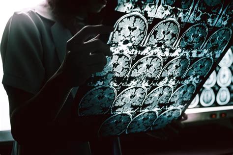 memory loss in alzheimer s patients could soon be reversed the healthy