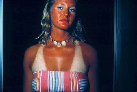 Hilarious Tanning Fails That Will Have You Reaching For