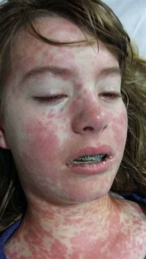 mum releases horrifying photos of teen daughter in desperate bid to identify mystery illness
