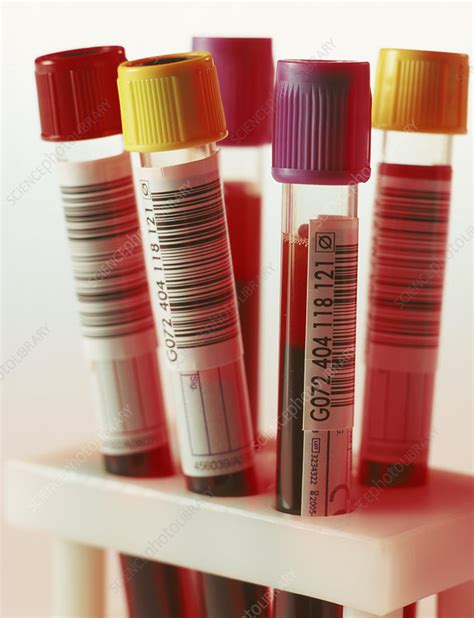 Blood Samples Stock Image M5300514 Science Photo Library