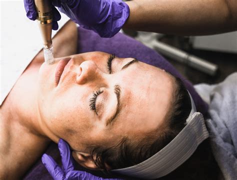 Medical Microneedling - Pearland Med Spa