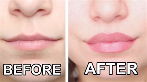 How To Get Bigger Lips Permanently With Exercise And Water