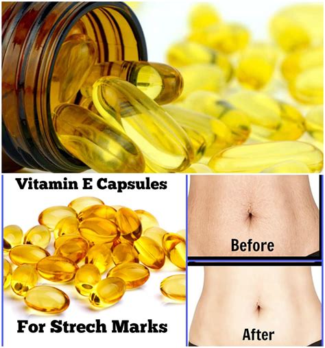 Conjugated vitamin e molecules are typically used in dietary supplements; Some Amazing Benefits of Vitamin E For Skin & Hair You ...