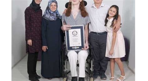 24 year old rumeysa gelgi of turkey is the tallest woman alive asian cars news