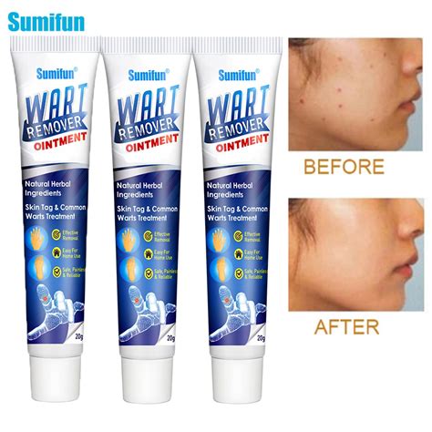 Instant Blemish Removal Gel🔥buy 1 Get 1 Free Wowelo