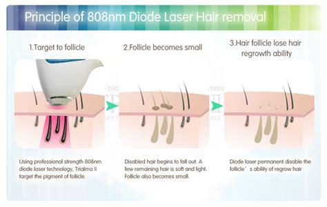 It's important to note that no documented cases of cancer or other devastating illnesses have been associated with laser hair removal at this point, but it's. Laser Hair Removal info | Somalaser