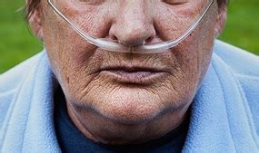 CDC - Health Effects - Smoking & Tobacco Use