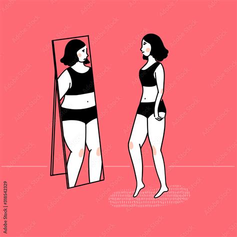 Slim Girl Looking At Fat Reflection In Mirror Eating Disorder Concept Body Dysmorphia Vector