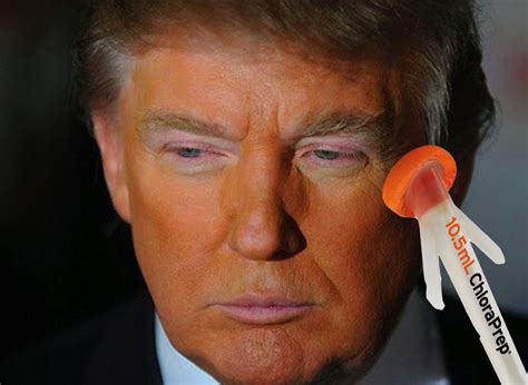 Donald Trumps Orange Complexion Due To Chloraprep From Last Plastic