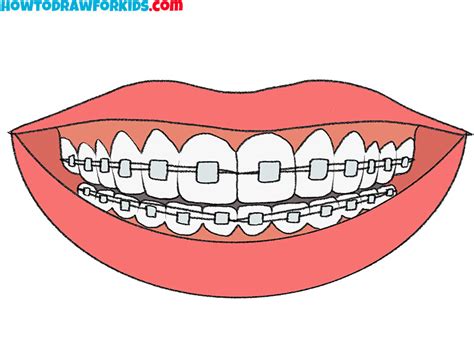 How To Draw Braces Easy Drawing Tutorial For Kids